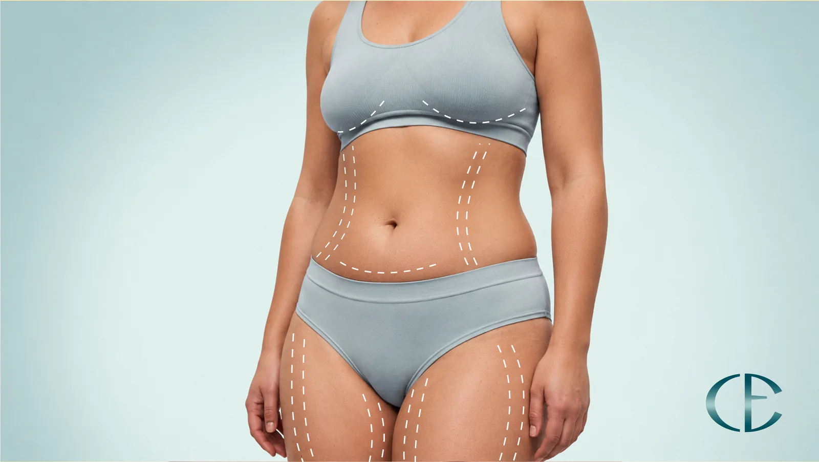 Adana mommy makeover (annelik estetiği) — Prof. Dr. Cengiz Eser