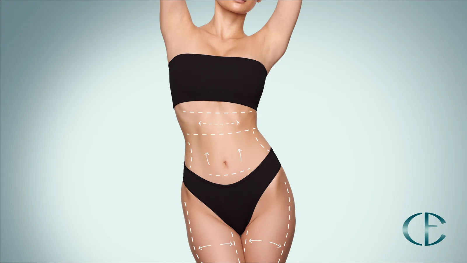 Liposuction and body contouring in Adana, Turkey — Prof. Dr. Cengiz Eser